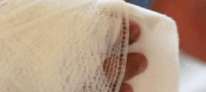 Reportan primer caso de quemado con pólvora en La Cruz, Nariño